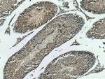 DCTN6 Antibody in Immunohistochemistry (Paraffin) (IHC (P))