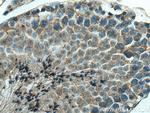 DCTN6 Antibody in Immunohistochemistry (Paraffin) (IHC (P))