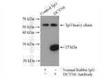 DCTN6 Antibody in Immunoprecipitation (IP)