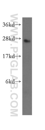 DCTN6 Antibody in Western Blot (WB)