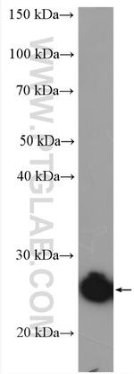 DCTN6 Antibody in Western Blot (WB)