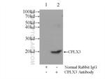 CPLX3 Antibody in Immunoprecipitation (IP)