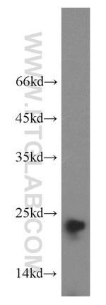 CPLX3 Antibody in Western Blot (WB)