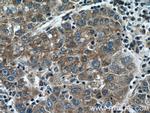 KLHL21 Antibody in Immunohistochemistry (Paraffin) (IHC (P))