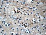 KLHL21 Antibody in Immunohistochemistry (Paraffin) (IHC (P))