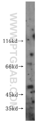 KLHL21 Antibody in Western Blot (WB)