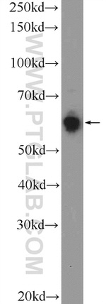 KLHL21 Antibody in Western Blot (WB)