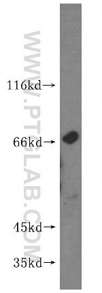 KLHL21 Antibody in Western Blot (WB)