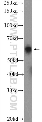 KLHL21 Antibody in Western Blot (WB)
