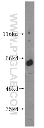MEF2C Antibody in Western Blot (WB)