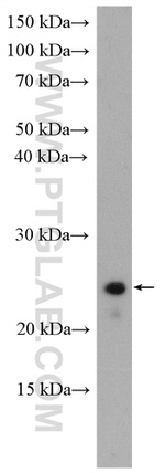 ARL6IP6 Antibody in Western Blot (WB)