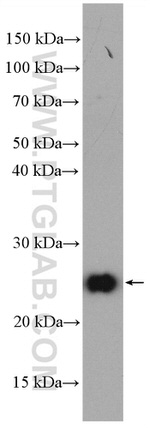 ARL6IP6 Antibody in Western Blot (WB)