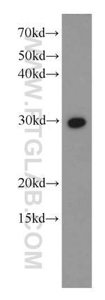 SYF2 Antibody in Western Blot (WB)