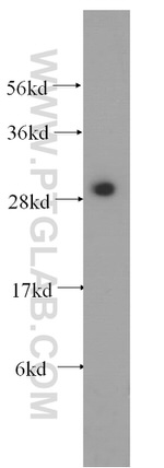 SYF2 Antibody in Western Blot (WB)