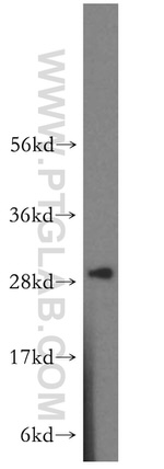 CA2 Antibody in Western Blot (WB)