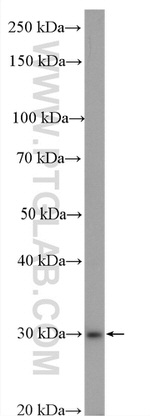CA2 Antibody in Western Blot (WB)
