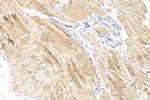 MYL6B Antibody in Immunohistochemistry (Paraffin) (IHC (P))