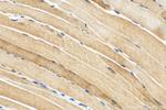 MYL6B Antibody in Immunohistochemistry (Paraffin) (IHC (P))