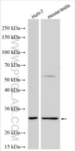 MYL6B Antibody in Western Blot (WB)