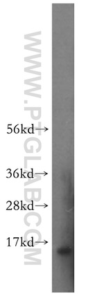 PDRG1 Antibody in Western Blot (WB)