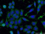 Syntabulin Antibody in Immunocytochemistry (ICC/IF)