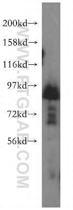 Syntabulin Antibody in Western Blot (WB)