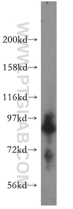 Syntabulin Antibody in Western Blot (WB)
