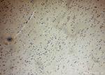 FANCC Antibody in Immunohistochemistry (Paraffin) (IHC (P))