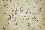 FANCC Antibody in Immunohistochemistry (Paraffin) (IHC (P))