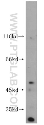 FANCC Antibody in Western Blot (WB)