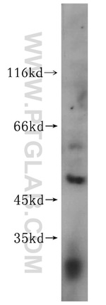 FANCC Antibody in Western Blot (WB)