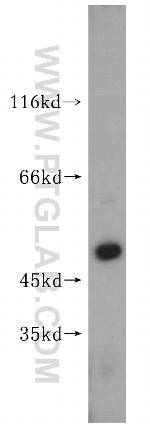 FANCC Antibody in Western Blot (WB)