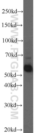 Frizzled 7 Antibody in Western Blot (WB)