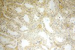 MRPL21 Antibody in Immunohistochemistry (Paraffin) (IHC (P))