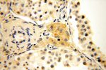 MRPL21 Antibody in Immunohistochemistry (Paraffin) (IHC (P))