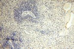 MRPL21 Antibody in Immunohistochemistry (Paraffin) (IHC (P))