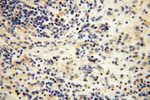 MRPL21 Antibody in Immunohistochemistry (Paraffin) (IHC (P))