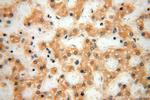 MRPL21 Antibody in Immunohistochemistry (Paraffin) (IHC (P))