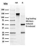GLIS family zinc finger 3 (GLIS3)/ZNF515 Antibody in SDS-PAGE (SDS-PAGE)