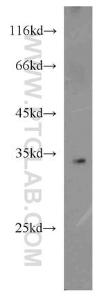 RPL8 Antibody in Western Blot (WB)