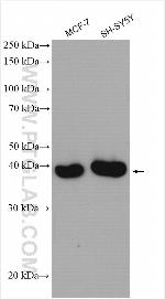 METTL2B Antibody in Western Blot (WB)