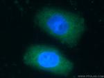 KCNJ3 Antibody in Immunocytochemistry (ICC/IF)