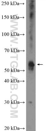 KCNJ3 Antibody in Western Blot (WB)