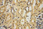 HSDL1 Antibody in Immunohistochemistry (Paraffin) (IHC (P))