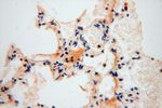 HSDL1 Antibody in Immunohistochemistry (Paraffin) (IHC (P))