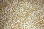 HSDL1 Antibody in Immunohistochemistry (Paraffin) (IHC (P))