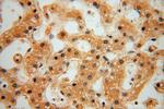 HSDL1 Antibody in Immunohistochemistry (Paraffin) (IHC (P))