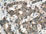 HSDL1 Antibody in Immunohistochemistry (Paraffin) (IHC (P))