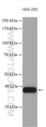 HSDL1 Antibody in Western Blot (WB)