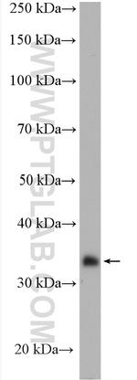 HSDL1 Antibody in Western Blot (WB)